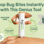 Itchy Bug Bites