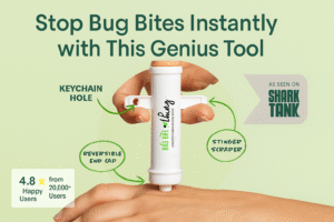 Itchy Bug Bites