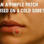 Can You Use a Pimple Patch on a Cold Sore? | Complete Guide
