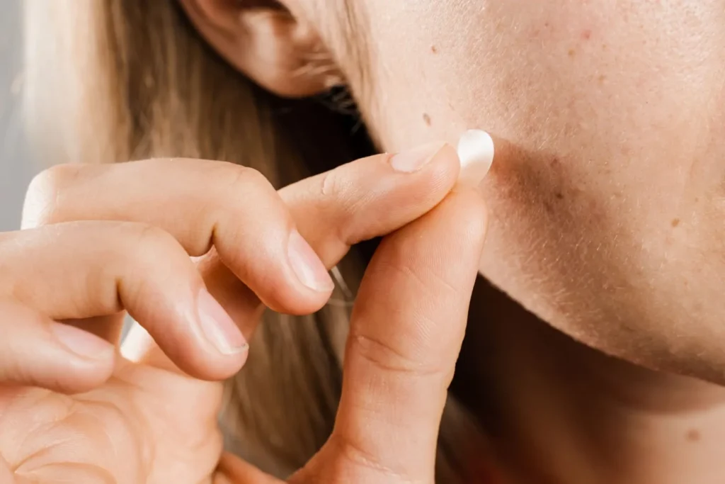 Pimple Patches
